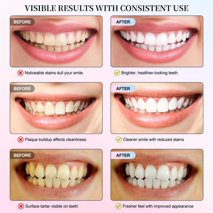 Niacinamide Whitening Toothpaste